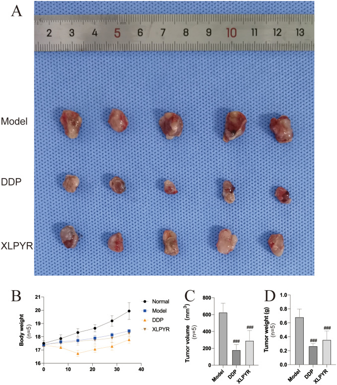 Xiaoliu Pingyi Pecipe Inhibits Lung Pre-Metastatic Niche Formation and Prevents Myeloid-Derived Suppressor Cells Recruitment.