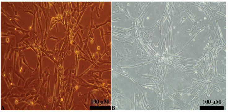 The Effect of Rosmarinic Acid on Neural Differentiation of Wartons Jelly-derived Mesenchymal Stem Cells in Two-dimensional and Three-dimensional Cultures using Chitosan-based Hydrogel.