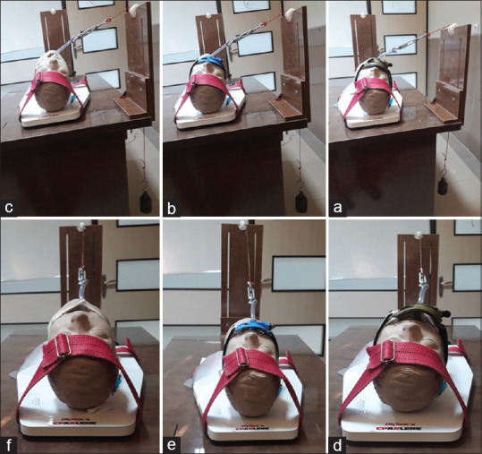 Comparison of the Effectiveness of Two Types of Commercial Endotracheal Tube Holders, with the Conventional Method in a Manikin Model.