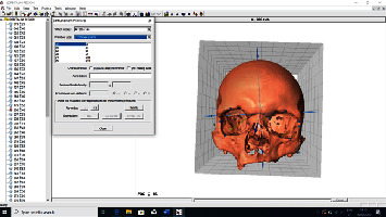 A Geometric Morphometrics Approach for Sex Estimation Based on the Orbital Region of Human Skulls from Bosnian Population.