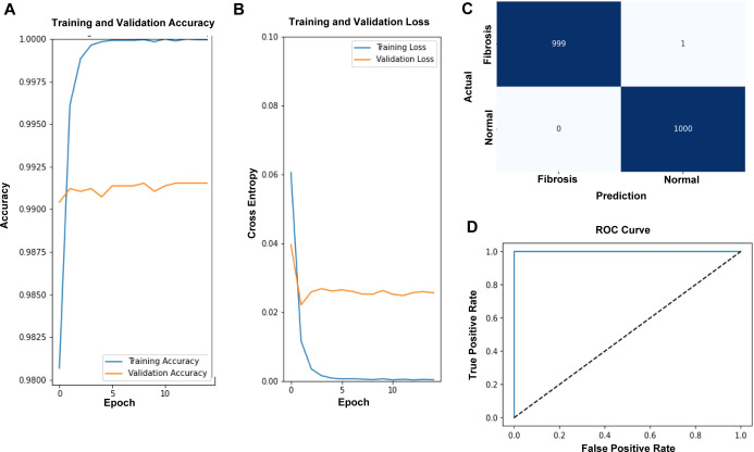 Application of convolutional neural network for analyzing hepatic fibrosis in mice.