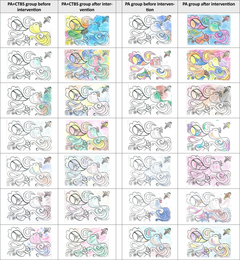 Non-invasive Brain Stimulation and Prism Adaptation in Art Constructive Errors in Painting.