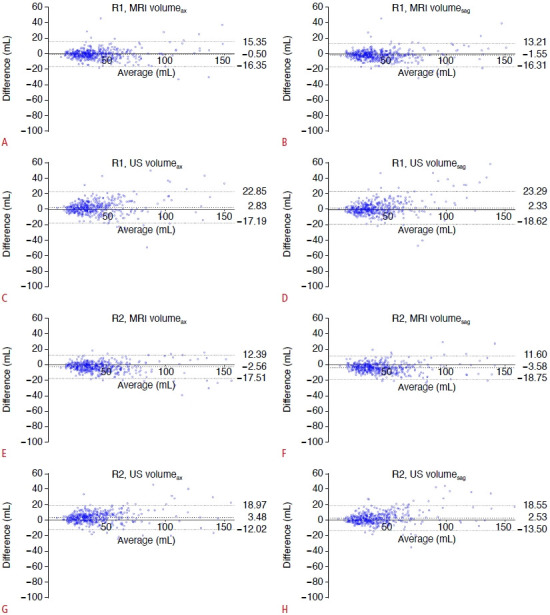 Prostate gland volume estimation: anteroposterior diameters measured on axial versus sagittal ultrasonography and magnetic resonance images.