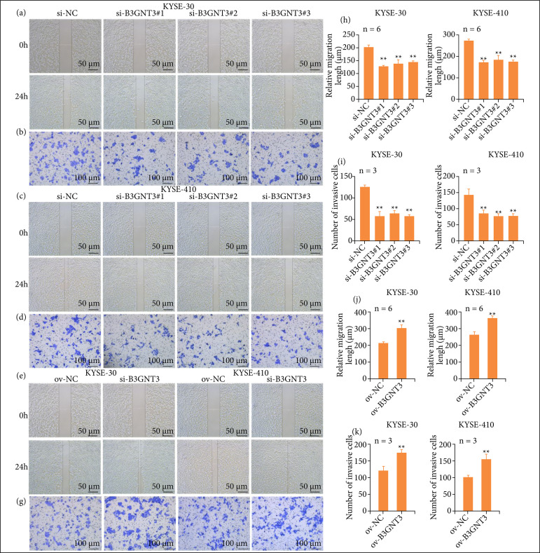 The role of B3GNT3 as an oncogene in the growth, invasion and migration of esophageal cancer cells.