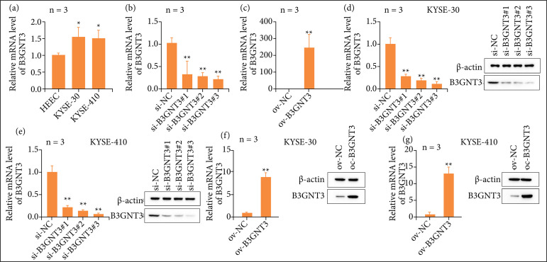 The role of B3GNT3 as an oncogene in the growth, invasion and migration of esophageal cancer cells.