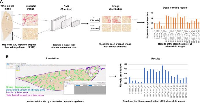 Application of convolutional neural network for analyzing hepatic fibrosis in mice.