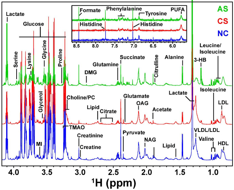 Pre-clinical Investigations of Therapeutic Markers Associated with Acute and Chronic Restraint Stress: A Nuclear Magnetic Resonance Based Contrast Metabolic Approach.