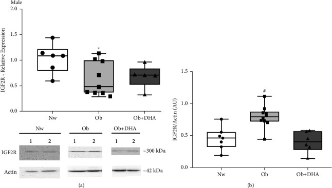 DHA Supplementation during Pregnancy in Women with Obesity Normalizes IGF2R Levels in the Placenta of Male Newborns.