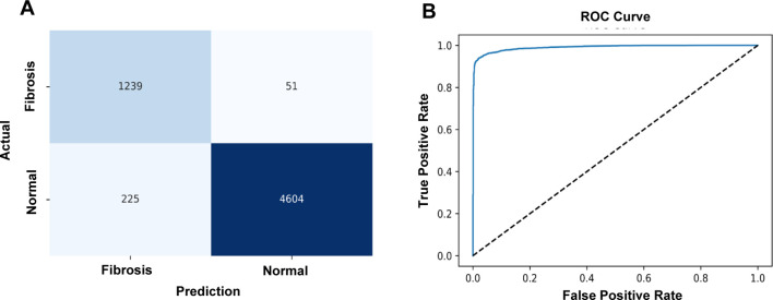 Application of convolutional neural network for analyzing hepatic fibrosis in mice.