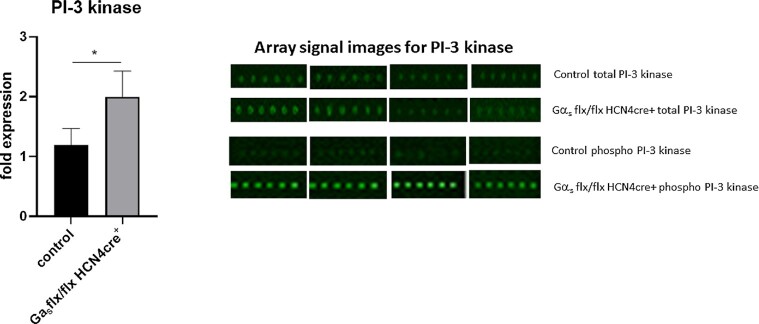 Slowing Heart Rate Protects Against Pathological Cardiac Hypertrophy.