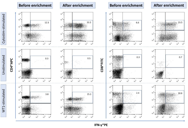 Cytotoxicity of WT1-reactive T cells against Wilms tumor: An implication for antigen-specific adoptive immunotherapy.