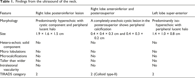 Recurrent Aggressive Fibromatosis Coexisting With Papillary Carcinoma Thyroid - Case Report.