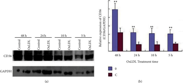 The Protective Role of Nrf2 in Renal Tubular Cells in Oxidised Low-Density Lipoprotein-Induced Fibrosis.