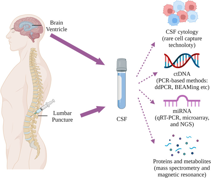 Fluids and flows in brain cancer and neurological disorders.