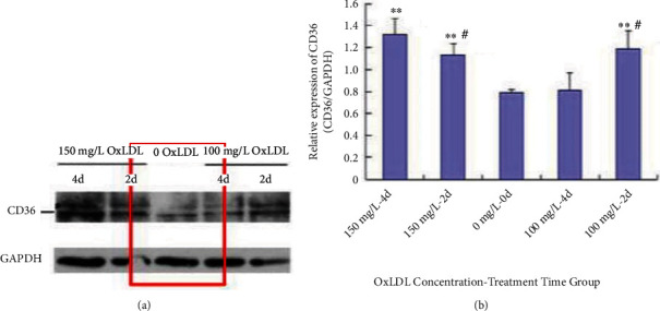 The Protective Role of Nrf2 in Renal Tubular Cells in Oxidised Low-Density Lipoprotein-Induced Fibrosis.