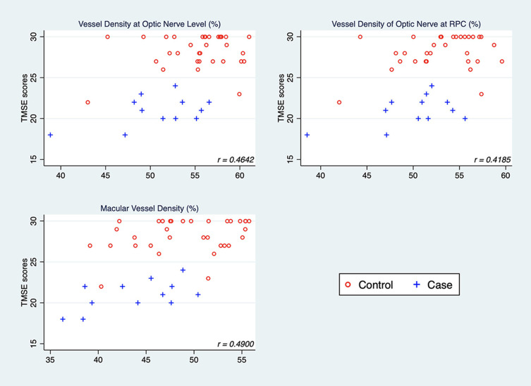 Changes in Ocular Biomarkers from Normal Cognitive Aging to Alzheimer's Disease: A Pilot Study.