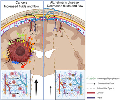 Fluids and flows in brain cancer and neurological disorders.