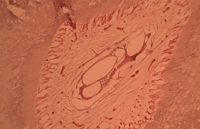 Histological characteristics of dental pulp in teeth with periodontal problems and healthy teeth.