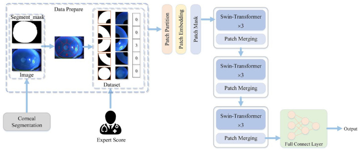 AES-CSFS: an automatic evaluation system for corneal sodium fluorescein staining based on deep learning.