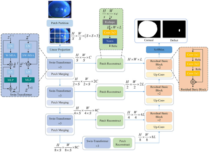 AES-CSFS: an automatic evaluation system for corneal sodium fluorescein staining based on deep learning.