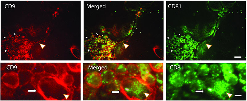 Receptor activator of nuclear factor-kappa B is enriched in CD9-positive extracellular vesicles released by osteoclasts.