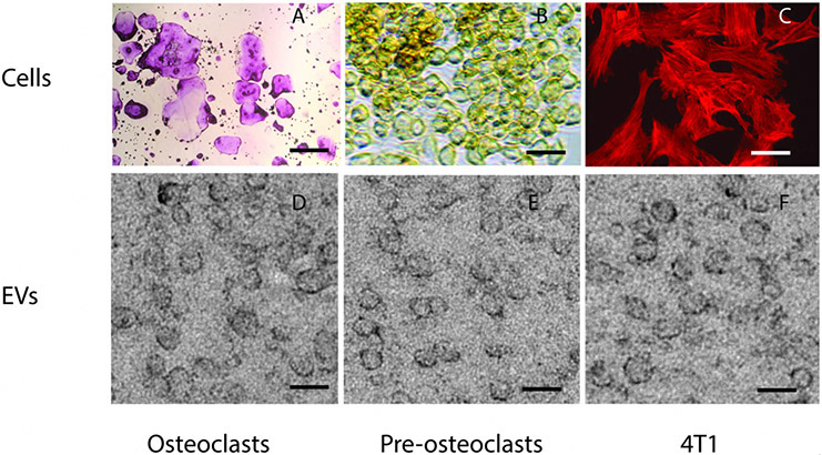 Receptor activator of nuclear factor-kappa B is enriched in CD9-positive extracellular vesicles released by osteoclasts.