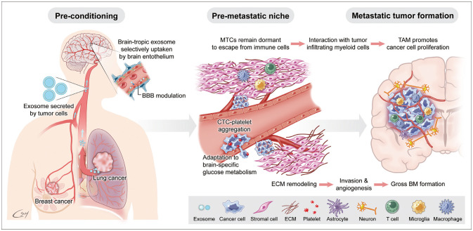 Molecular Biology of Brain Metastases.