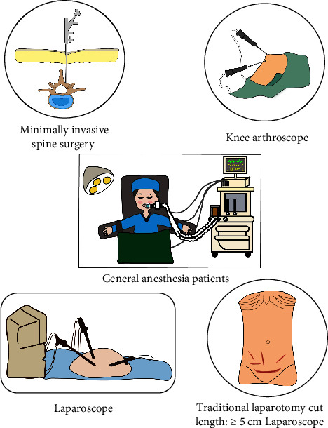 Analgesic Efficacy of Intravenous Ibuprofen in the Treatment of Postoperative Acute Pain: A Phase III Multicenter Randomized Placebo-ControlledDouble-Blind Clinical Trial.