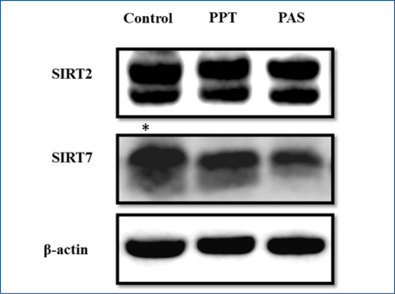 Expression of sirtuin 2 and 7 in placenta accreta spectrum.