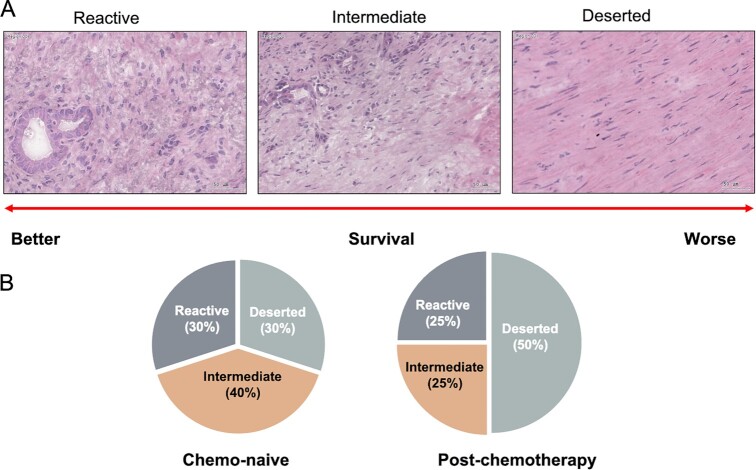 Refining the Treatment of Pancreatic Cancer From Big Data to Improved Individual Survival.