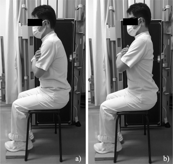 Measurement of spinopelvic sagittal alignment in the relaxed seated position rather than in the straight seated position is suitable for assessing spinopelvic mobility in patients before total hip arthroplasty.