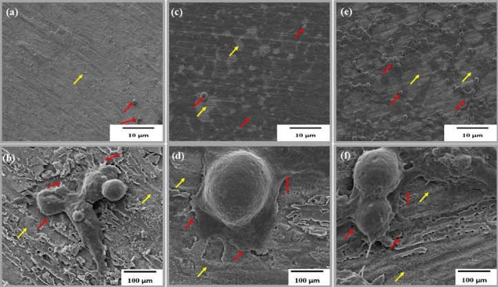 Localised Delivery of Cisplatin from Chitosan-Coated Titania Nanotube Array Nanosystems Targeting Nasopharyngeal Carcinoma.