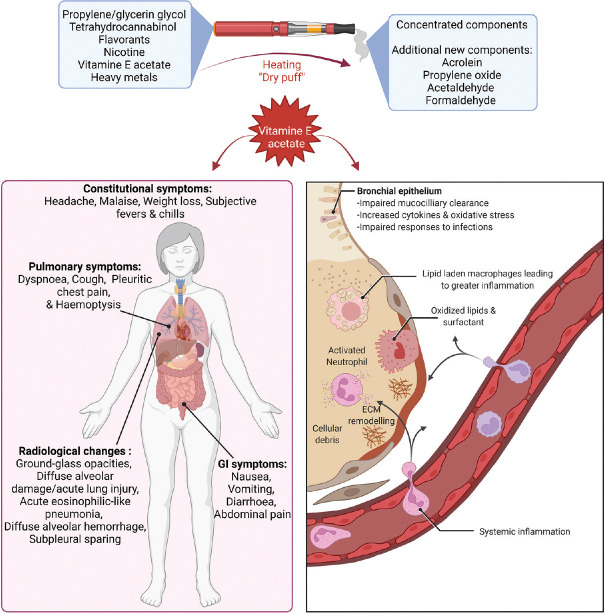 The implications of Vitamin E acetate in E-cigarette, or vaping, product use-associated lung injury.