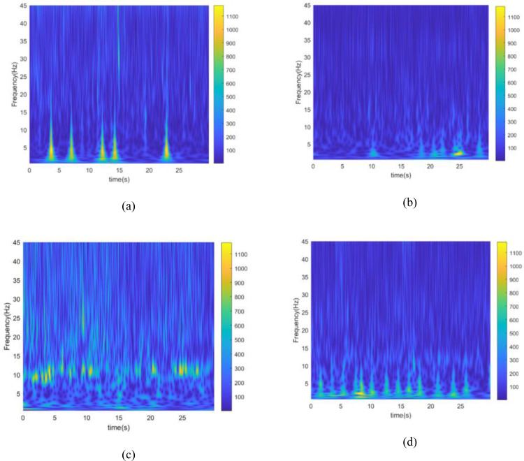 A Hybrid EEG-based Emotion Recognition Approach Using Wavelet Convolutional Neural Networks and Support Vector Machine.