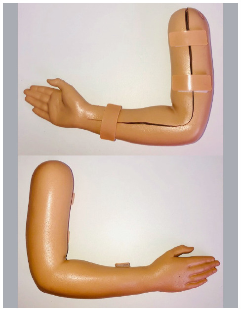 DEVELOPMENT OF ORTHOPEDIC SIMULATOR TO PRACTICE CLOSED REDUCTION OF PEDIATRIC FRACTURES OF THE MIDDLE THIRD OF FOREARM.