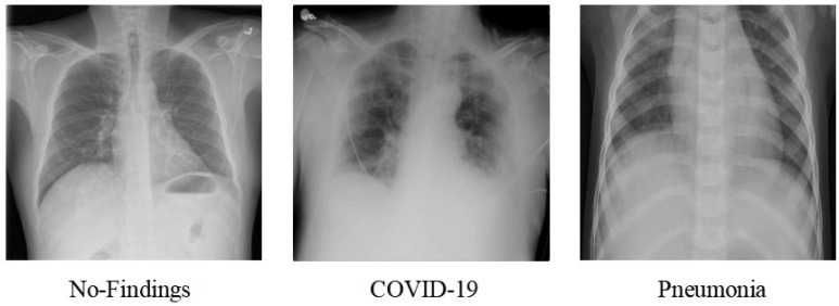 COVID-19 detection on chest X-ray images using Homomorphic Transformation and VGG inspired deep convolutional neural network