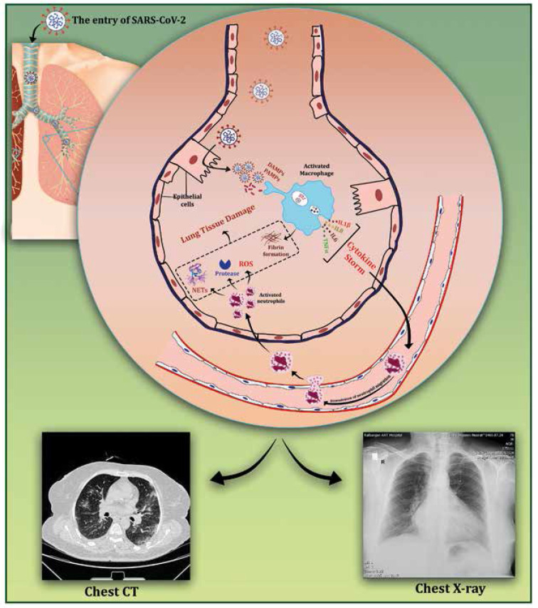 COVID-19 diagnostic approaches with an extensive focus on computed tomography in accurate diagnosis, prognosis, staging, and follow-up.