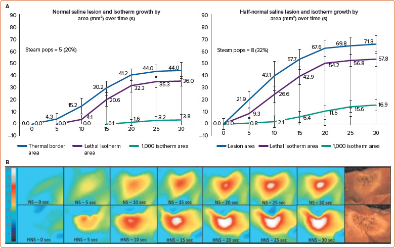 Solving the Reach Problem: A Review of Present and Future Approaches for Addressing Ventricular Arrhythmias Arising from Deep Substrate.