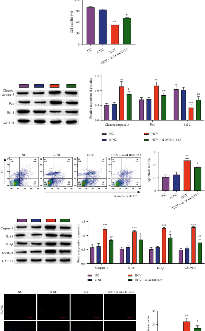 LncRNA AC040162.3 Promotes HCV-Induced T2DM Deterioration through the miRNA-223-3p/NLRP3 Molecular Axis.