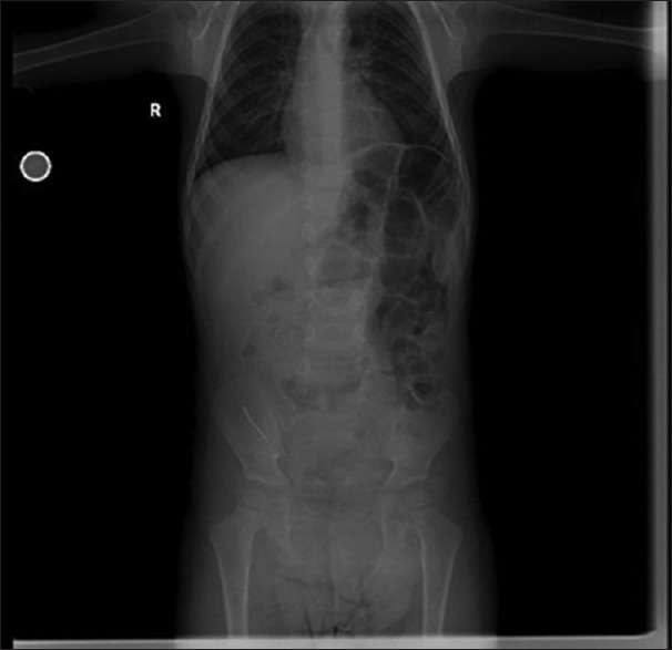 A Pediatric Right Lower Quadrant Pain Case.