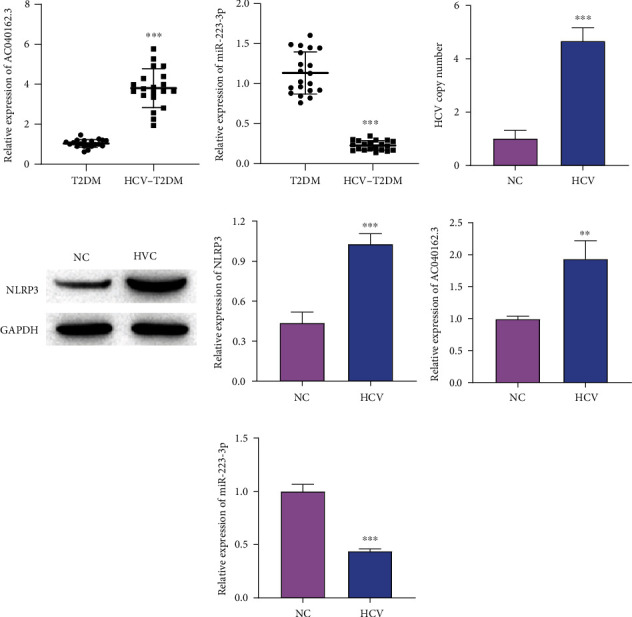 LncRNA AC040162.3 Promotes HCV-Induced T2DM Deterioration through the miRNA-223-3p/NLRP3 Molecular Axis.