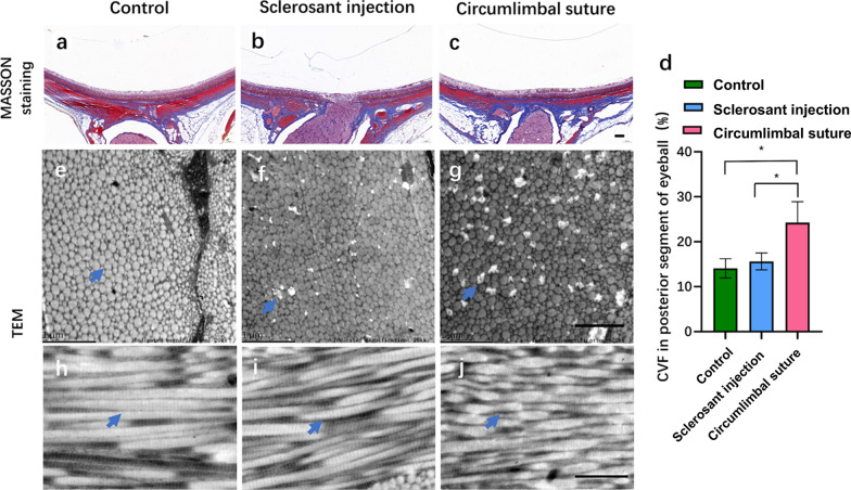 Regional differences of the sclera in the ocular hypertensive rat model induced by circumlimbal suture.