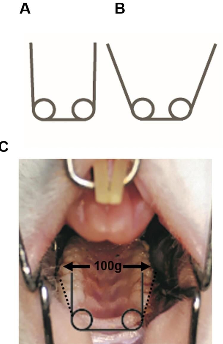 Suppressing STAT3 activation impairs bone formation during maxillary expansion and relapse.