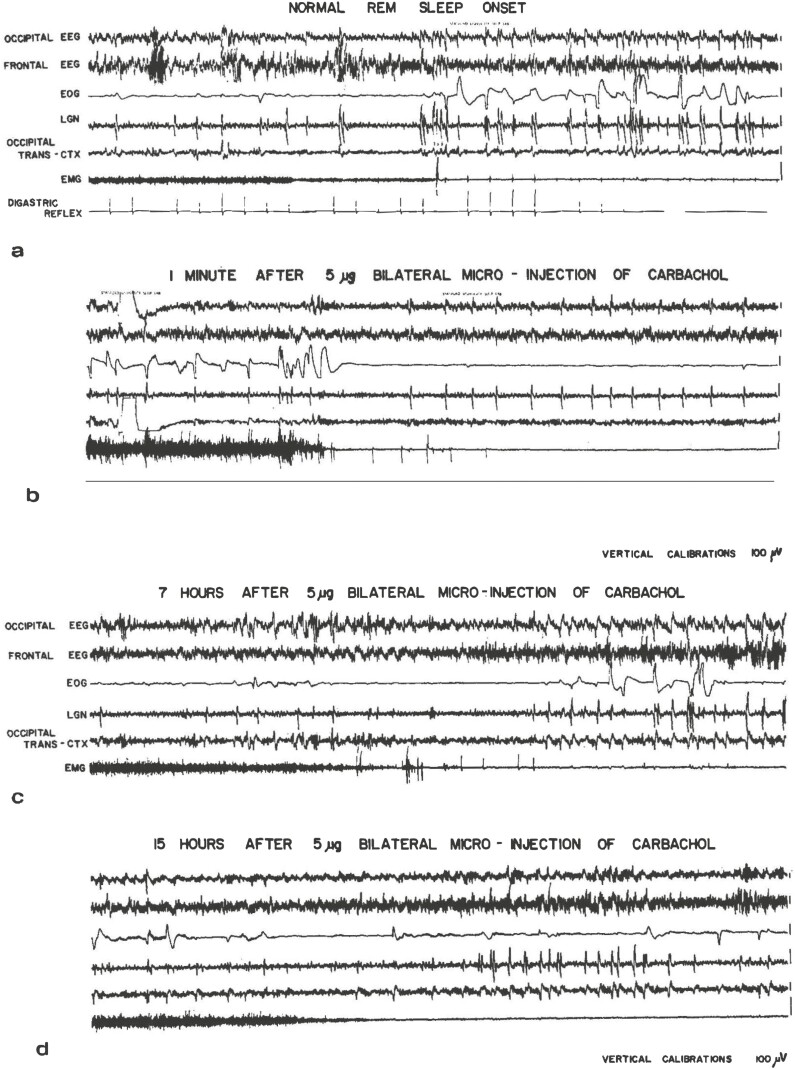 Fifty-five years in sleep research: contributions, experiences, and progress.