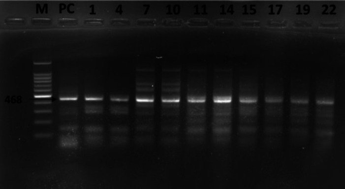 Pentraxin-3, endothelin-1, some biochemical parameters and hematology in bovine respiratory disease complex.