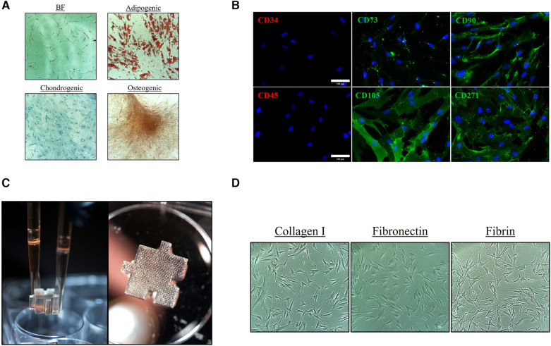 Tailoring the secretome composition of mesenchymal stem cells to augment specific functions of epidermal regeneration: an <i>in vitro</i> diabetic model.