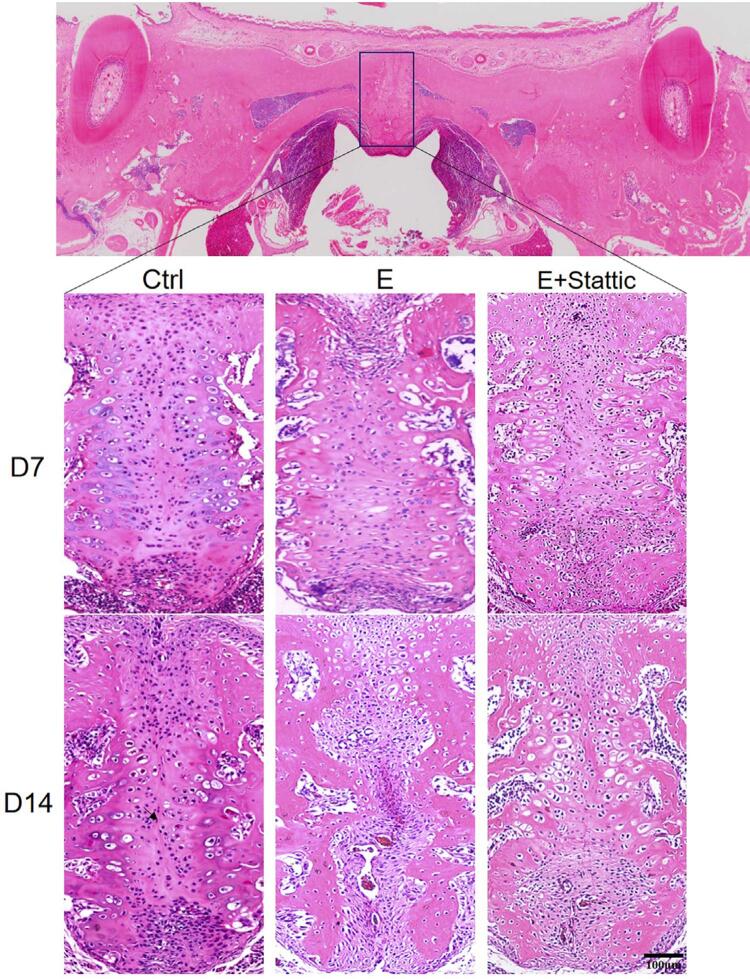 Suppressing STAT3 activation impairs bone formation during maxillary expansion and relapse.