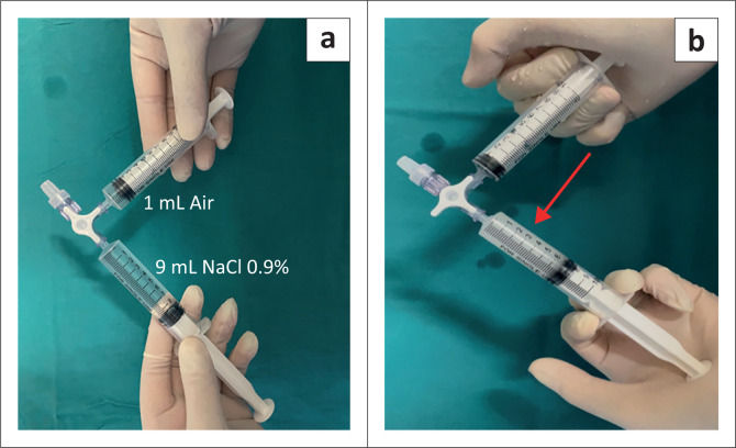 Comparison between ultrasound and chest X-ray to confirm central venous catheter tip position.