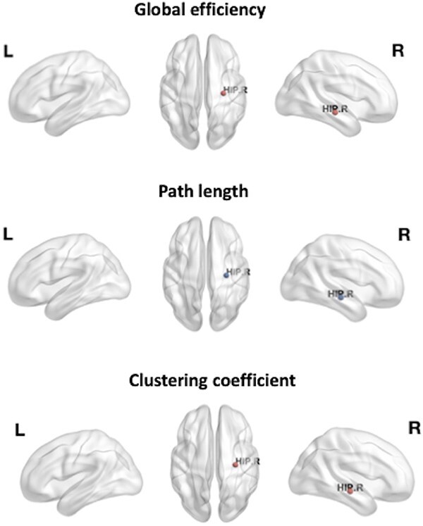 Increased hippocampal efficiency is associated with greater headache frequency in adolescents with chronic headache.