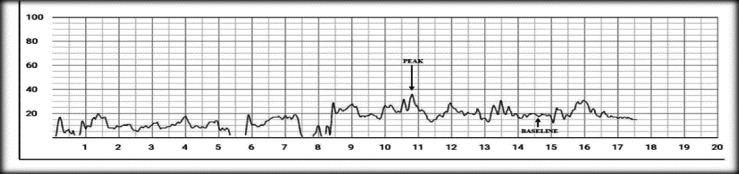 Tocodynamometric study of uterine contractions during parturition in queens.